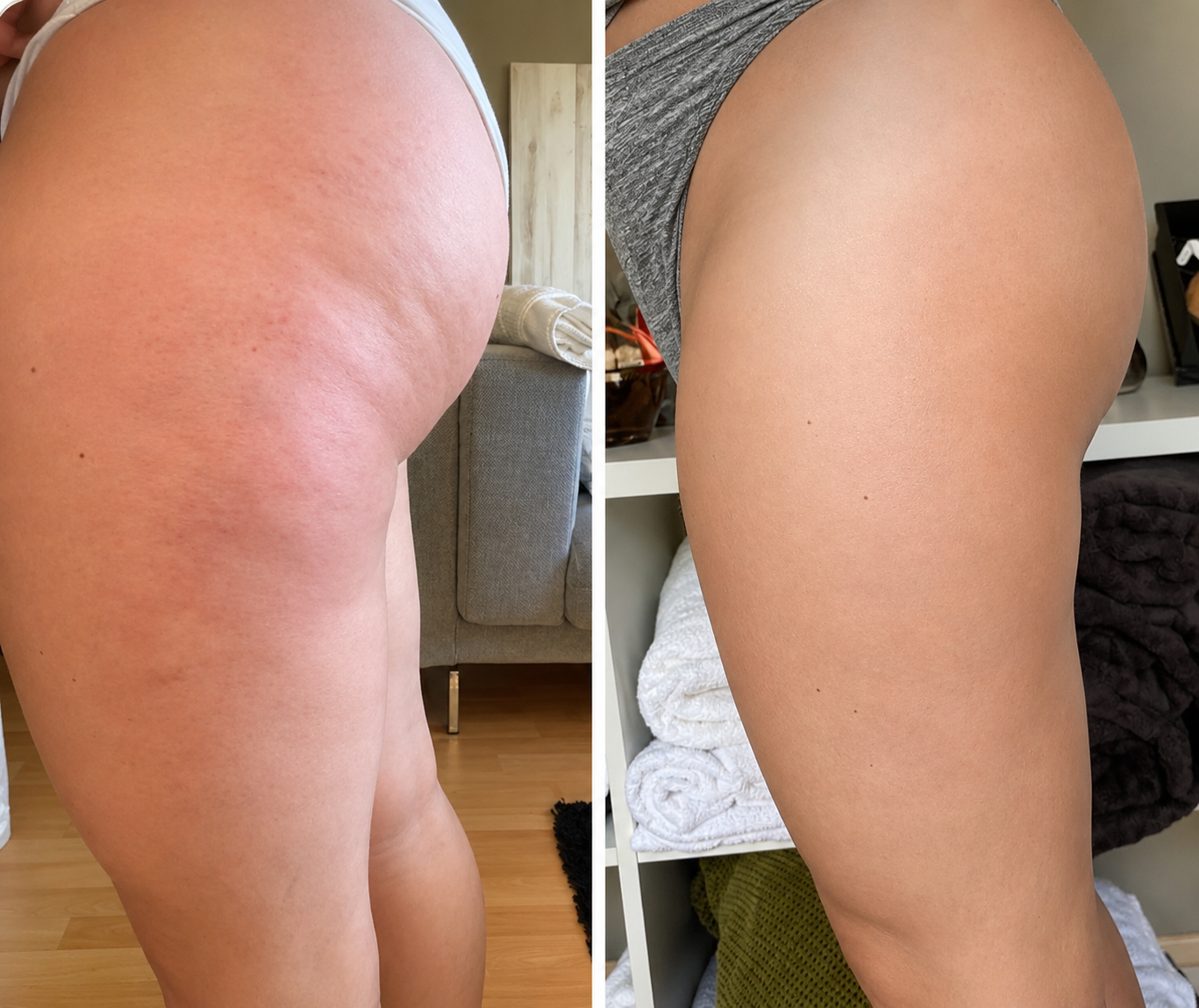 Straffendes Anti-Cellulite Massageöl