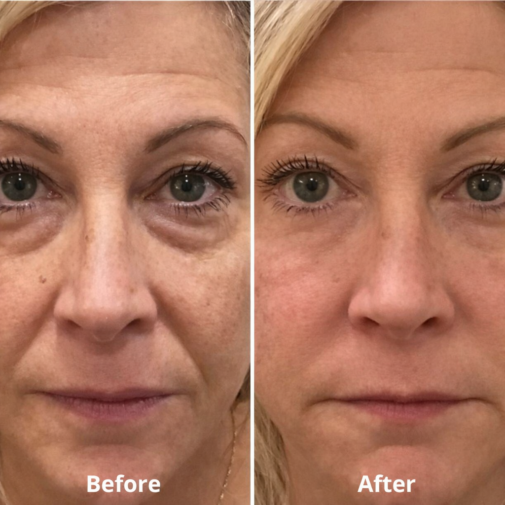 QINGLIN Rutina Oblíbený anti-aging rituál
Oční okolí a tělo