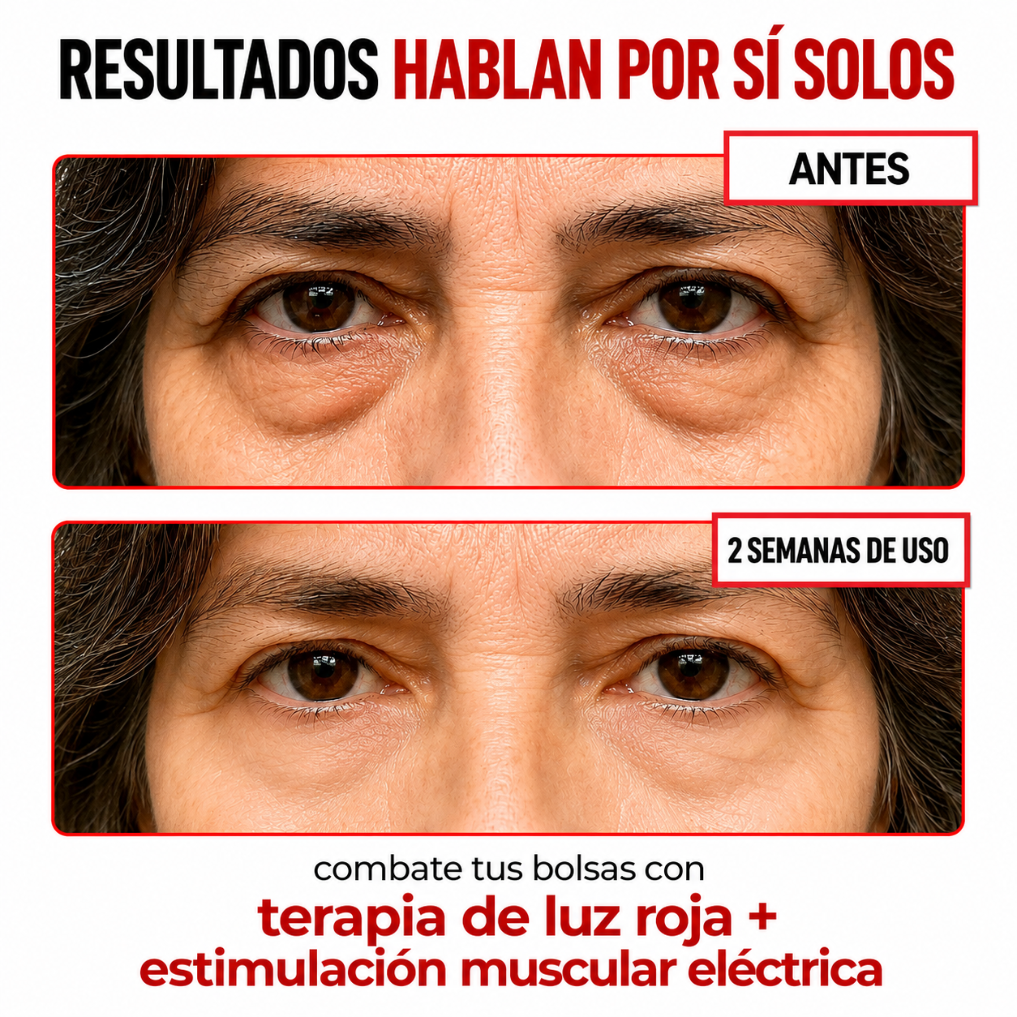 LumiEyes Lunettes Régénérantes